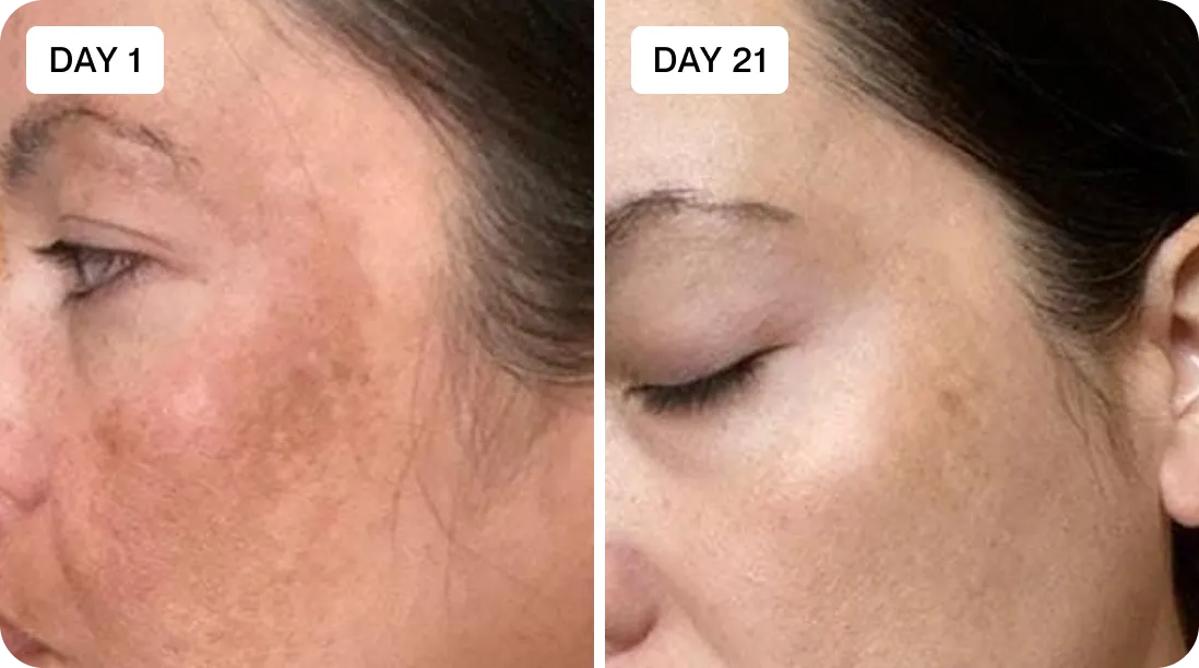 Amelia before and after results