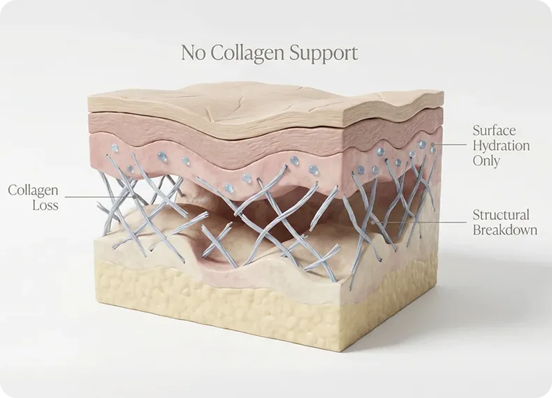 No collagen support diagram