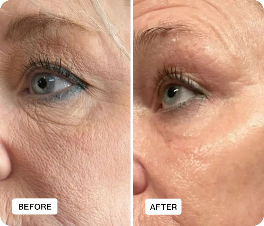 Before and after result 3