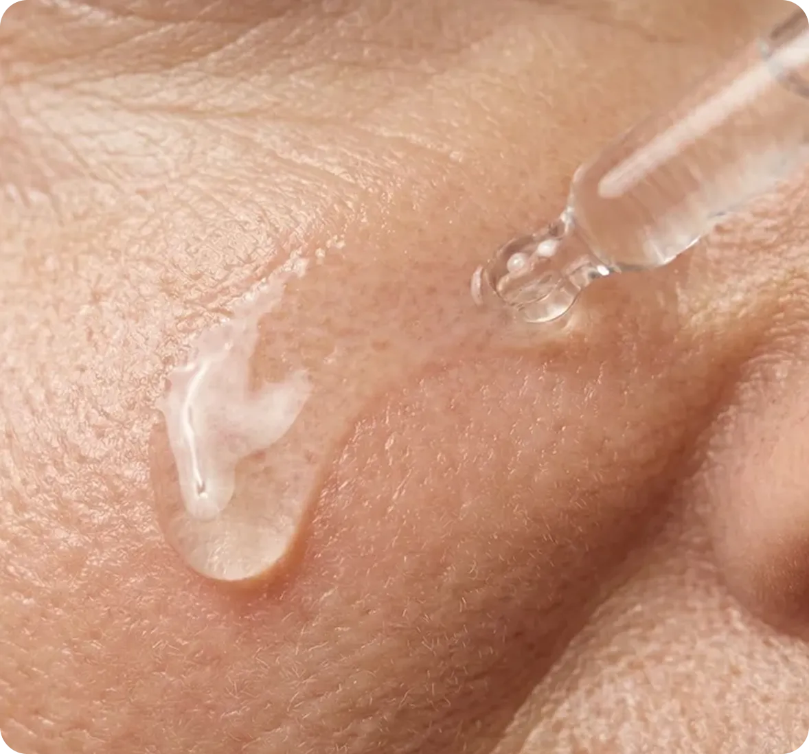 Study 2 wrinkle reduction visual