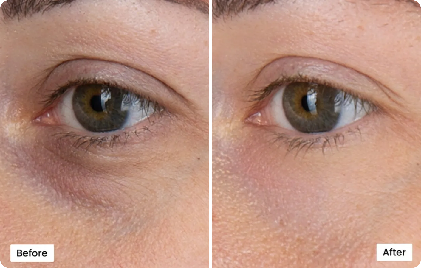 Omnilux before and after