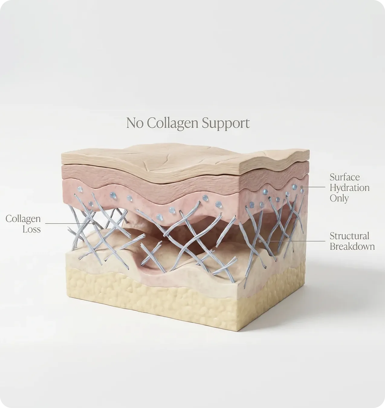No collagen support diagram