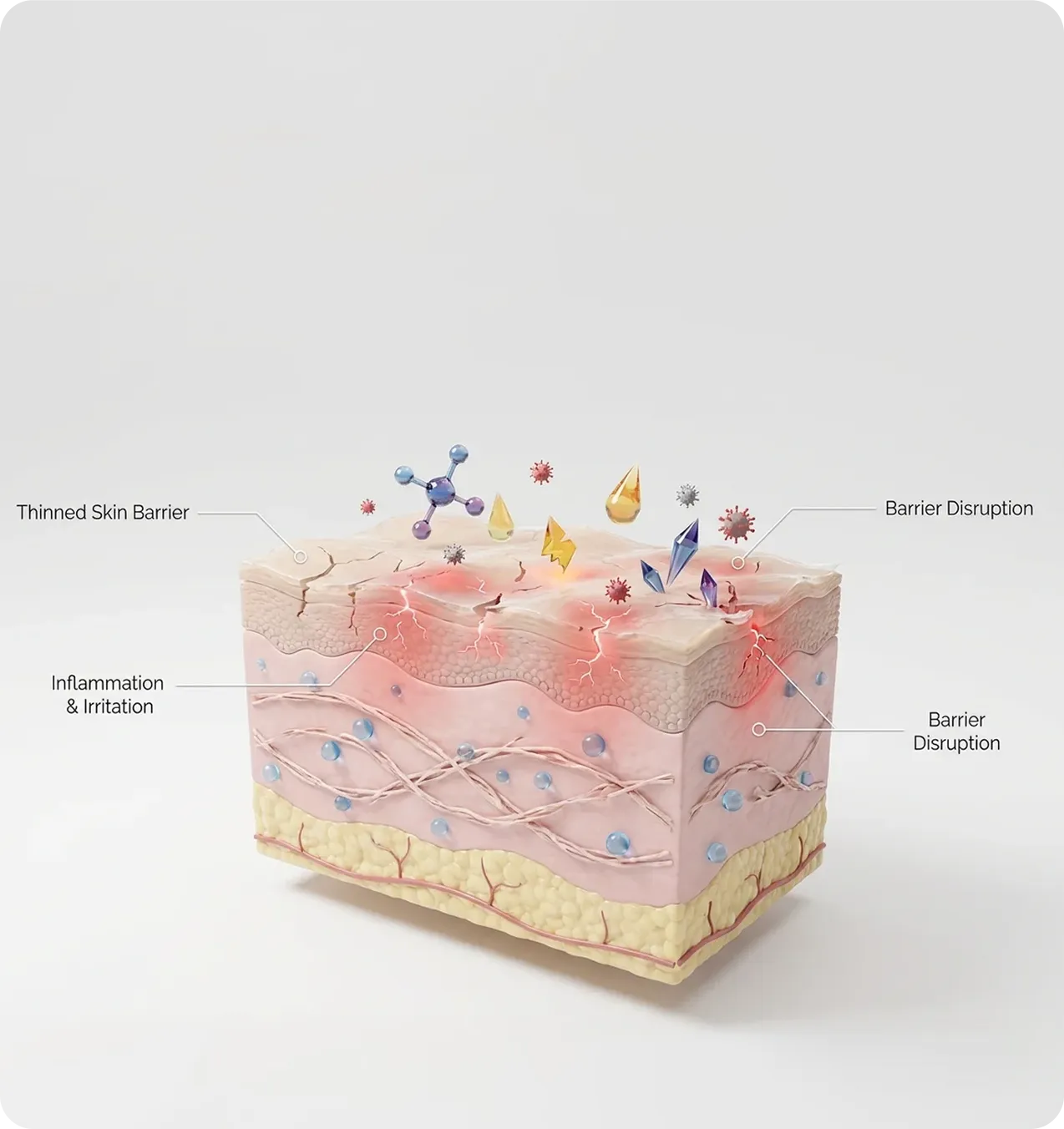 Skin barrier damage diagram