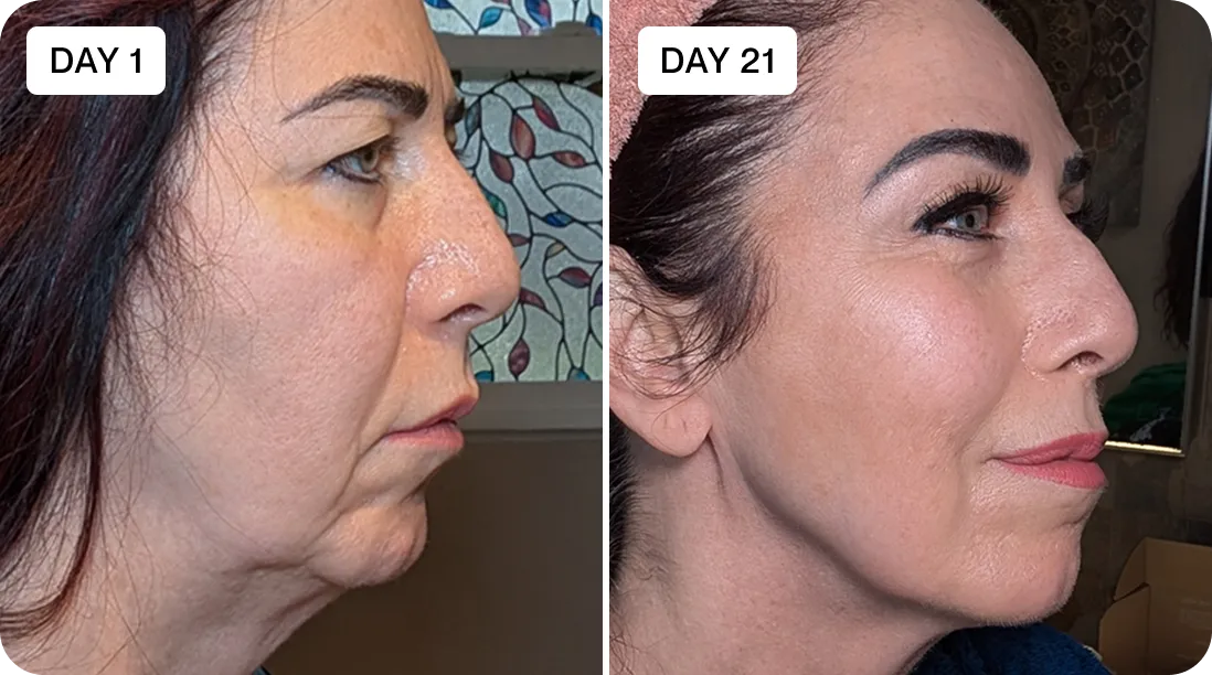 Claire before and after result