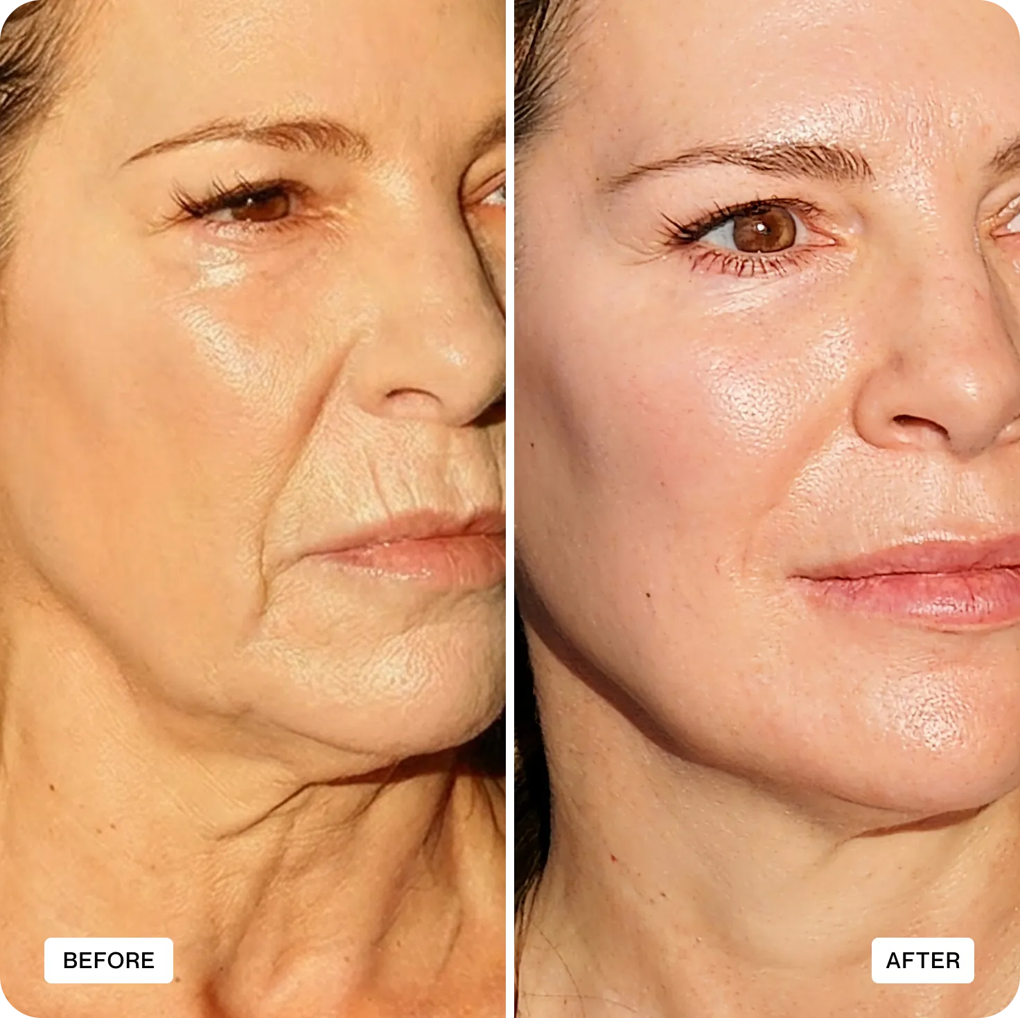 Before and after results