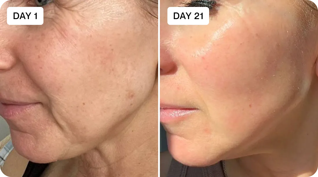 Bessie before and after result