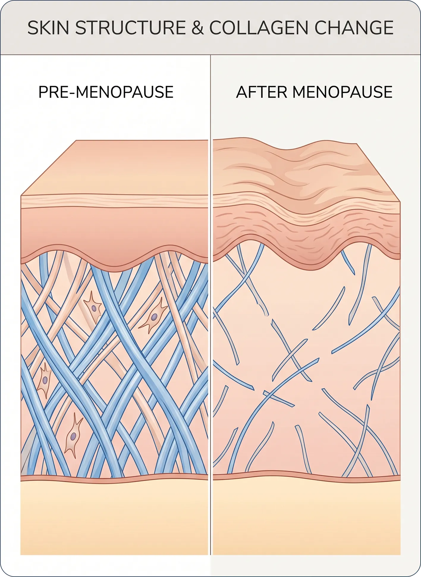 Skin structure and collagen changes before and after menopause