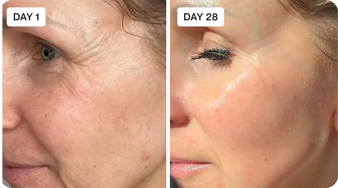 Debra before and after using Renewa Skin patches