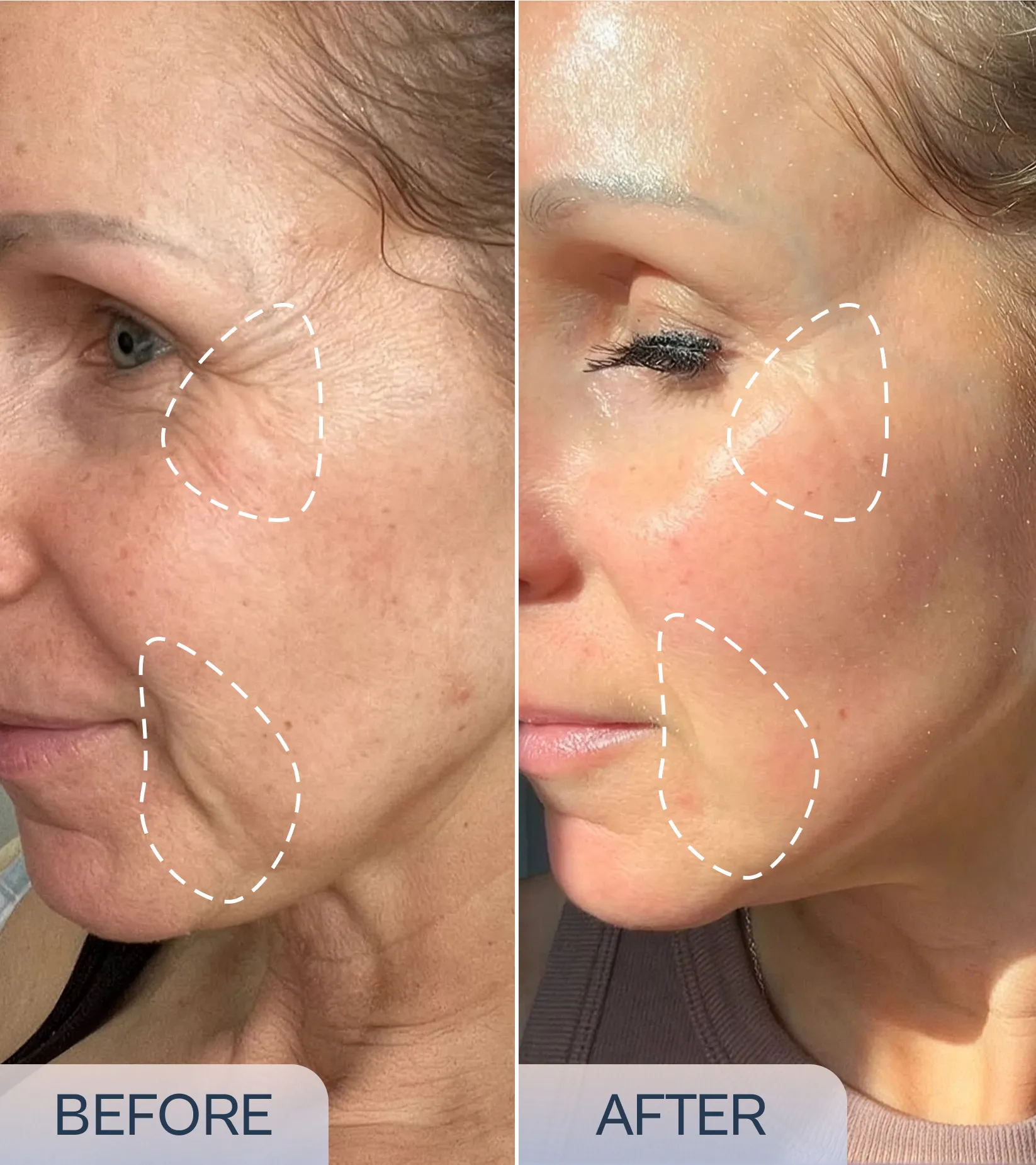 Micro-Infusion Precision Patches product image 4