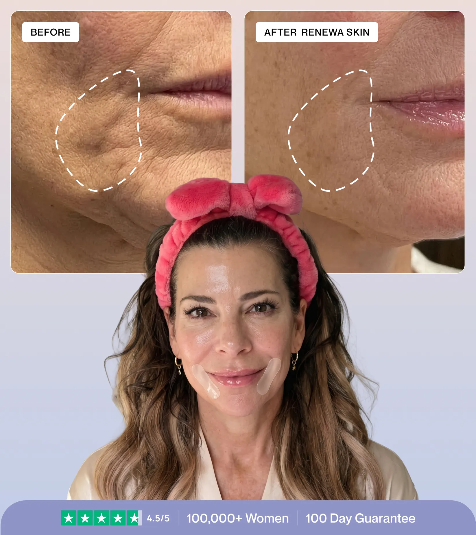 Micro-Infusion Precision Patches product image 11