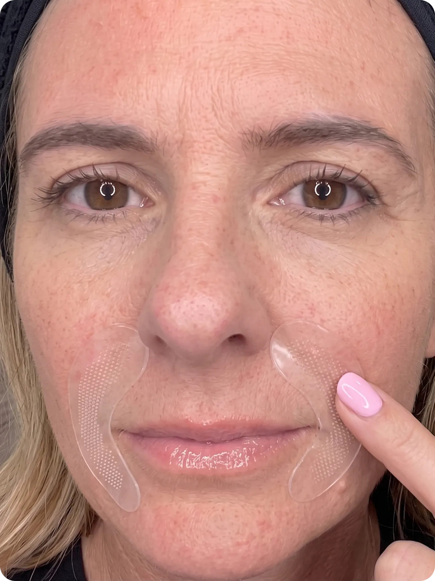 Woman wearing Renewa Skin Micro-Infusion Precision Patches