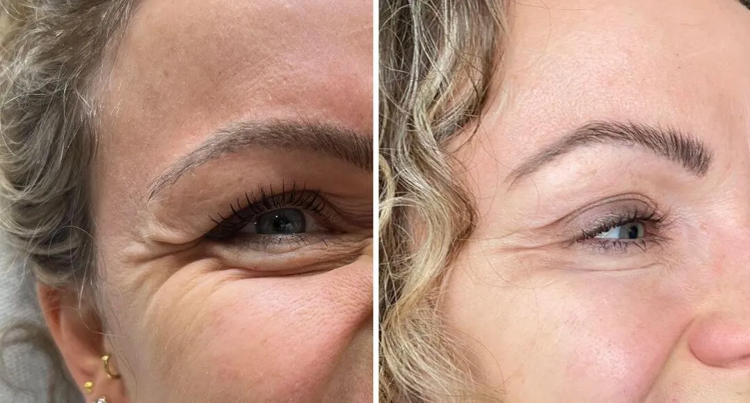 Better Than Every Eye Cream I've Tried