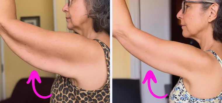 Arm transformation results