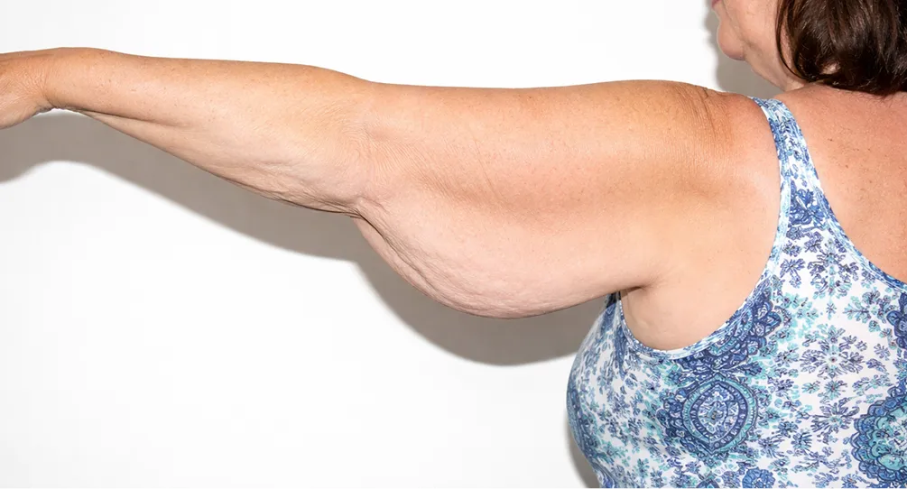 Woman with grandma arms