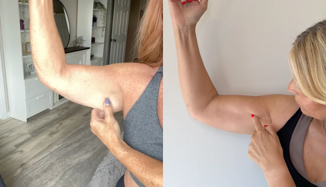 Arm Toning Solutions