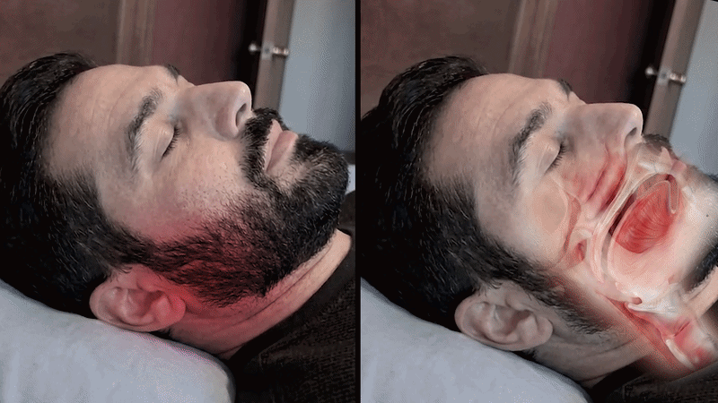 Conceptual image of mental fatigue building over time