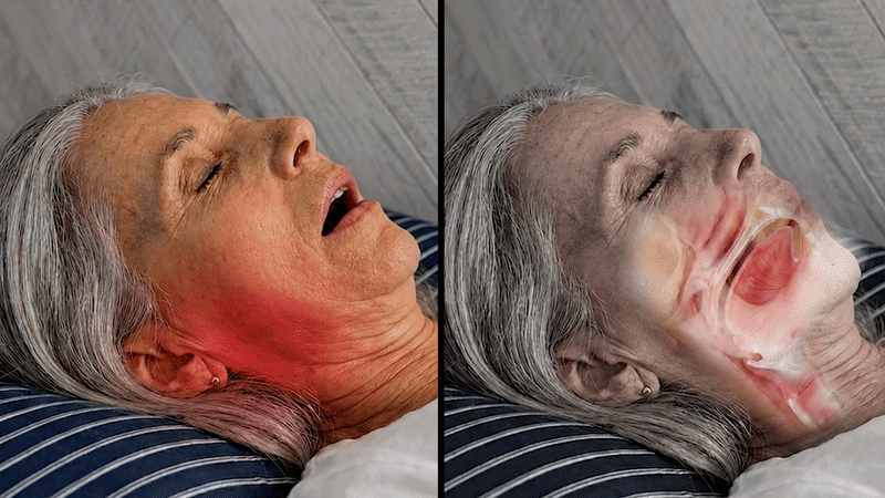 How the jaw and airway behave during sleep