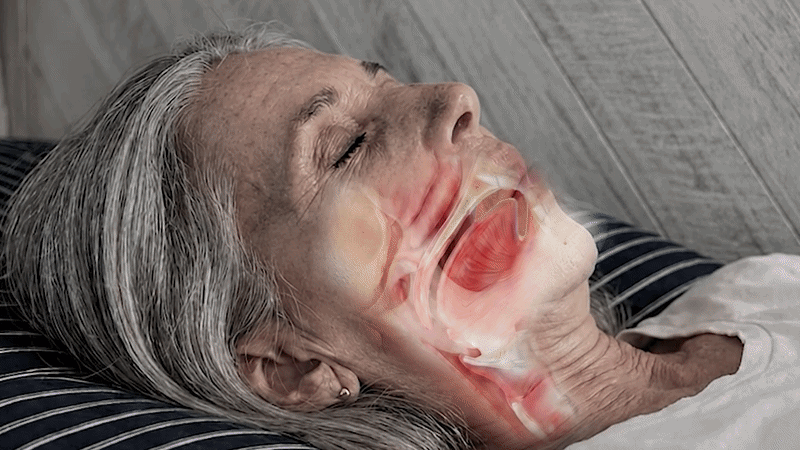 How the airway narrows during sleep