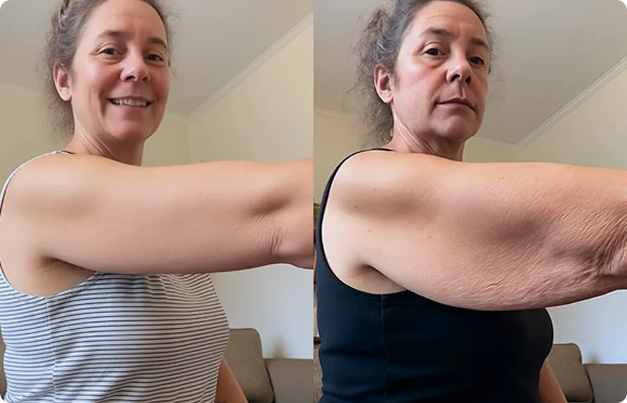 Customer using MyoGlow device