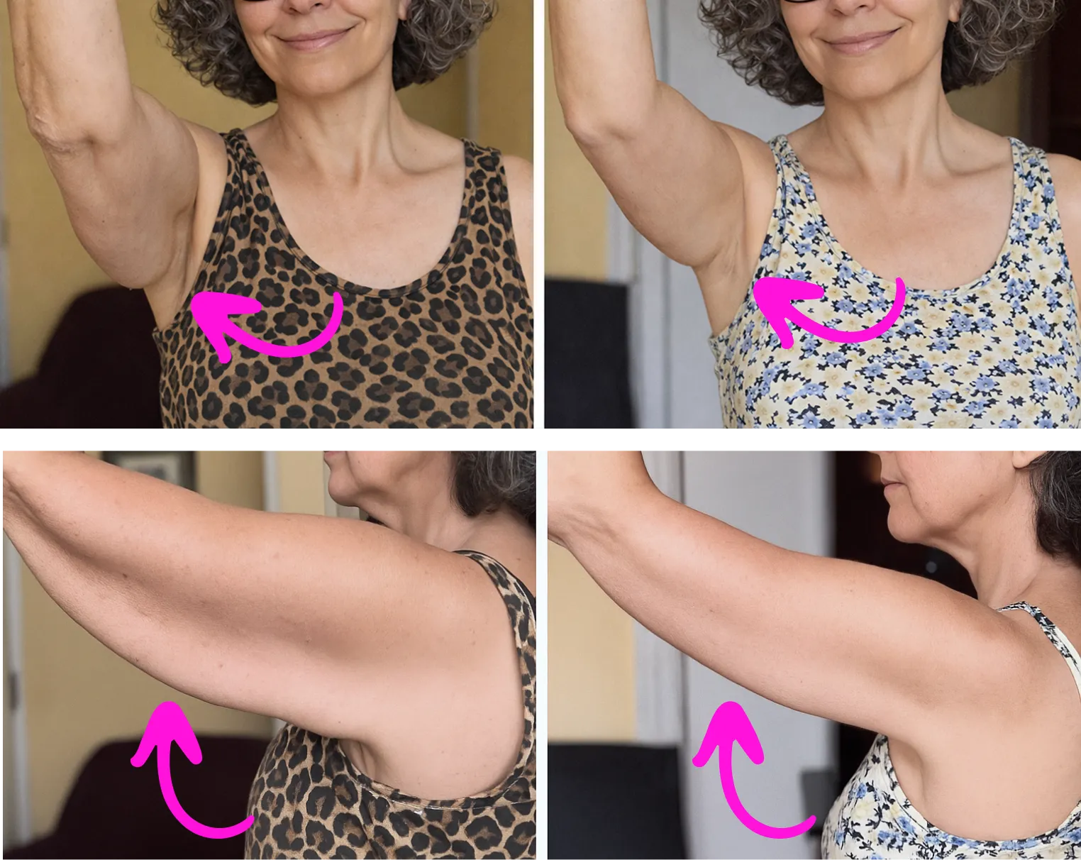 Couple cuddling with RestōrV bottle