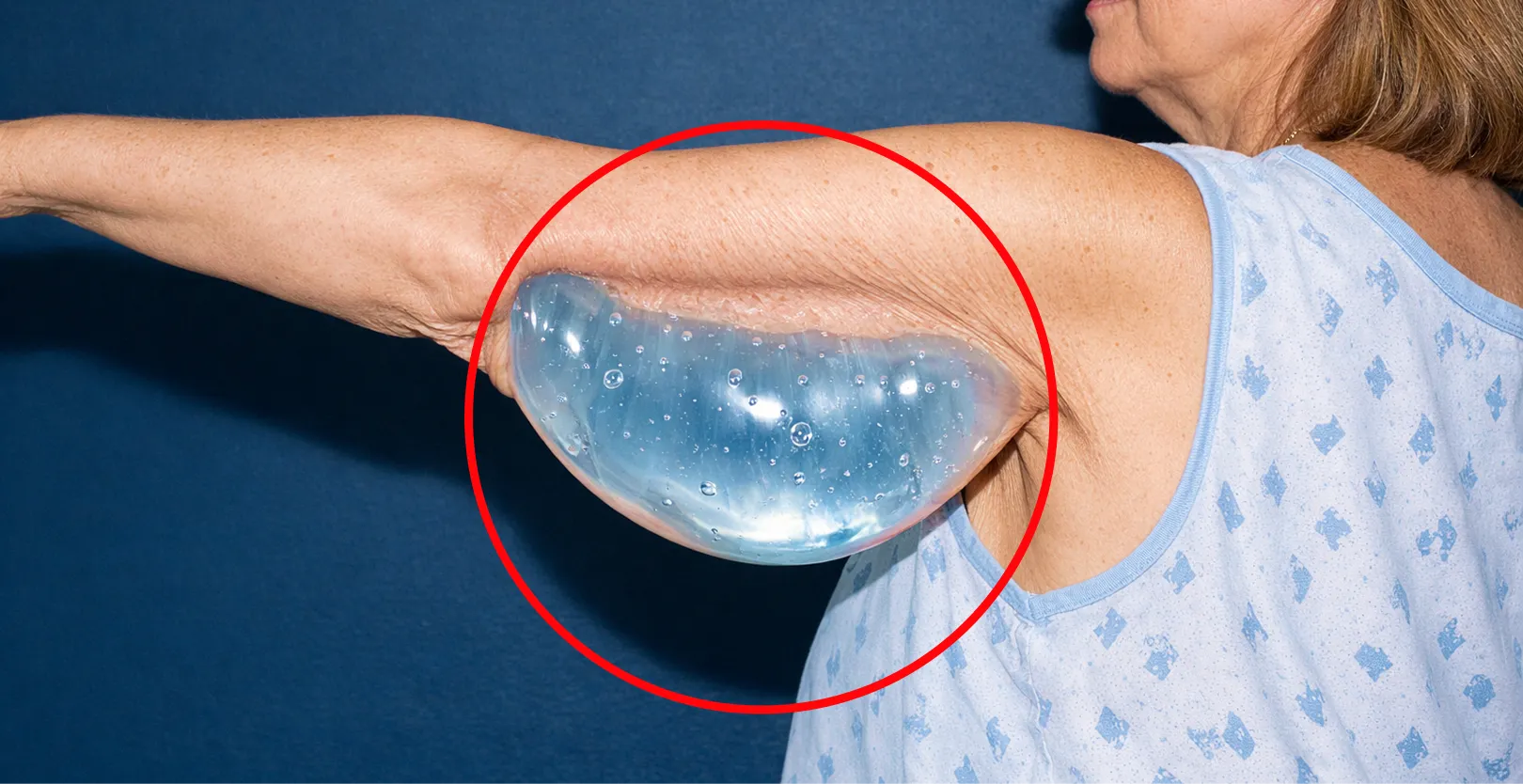 Woman with fish visual metaphor