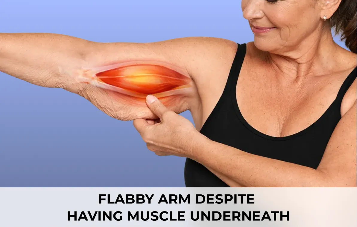 Lymphatic fluid diagram