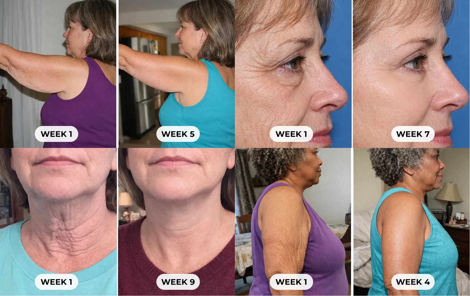 Lymphatic fluid diagram