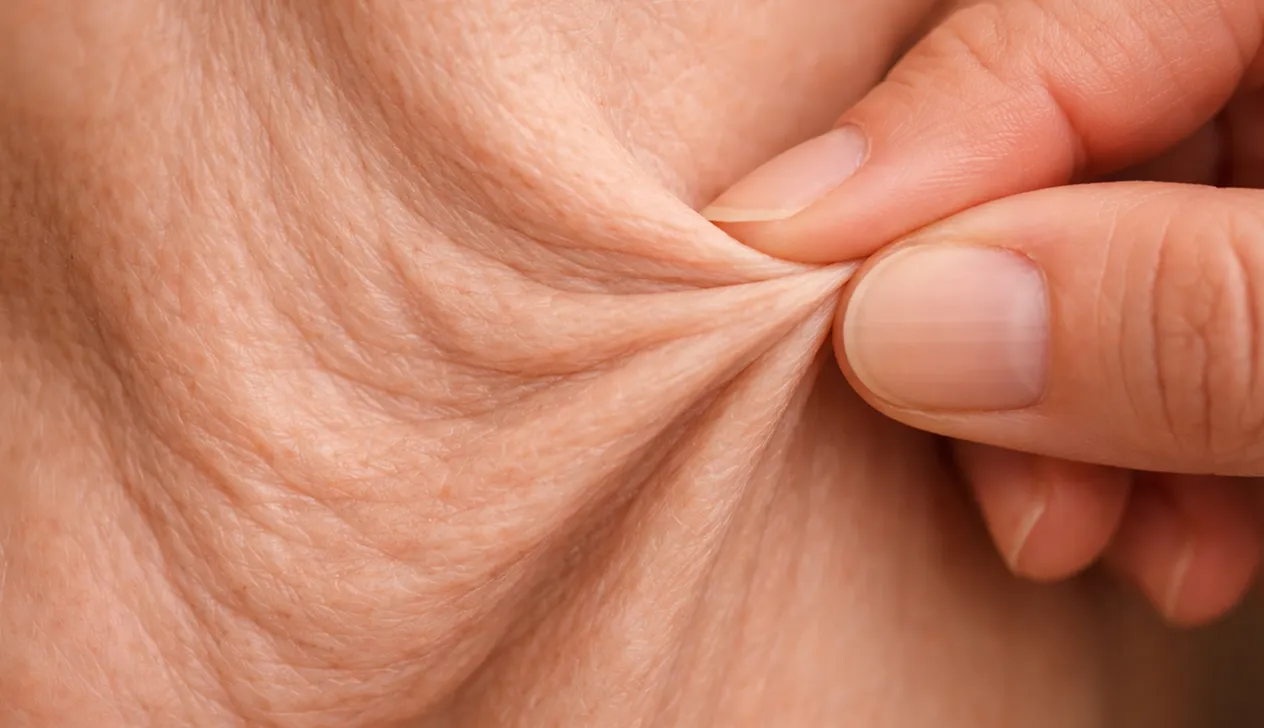 Fats, Protein, Sugars, Carbs - Flabby Arms