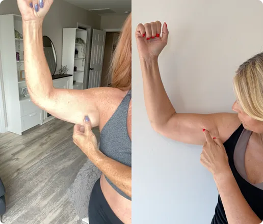 Customer using MyoGlow device