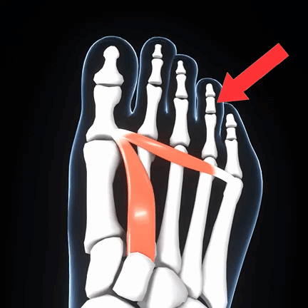 KnieFlex Therapiegerät in der Anwendung
