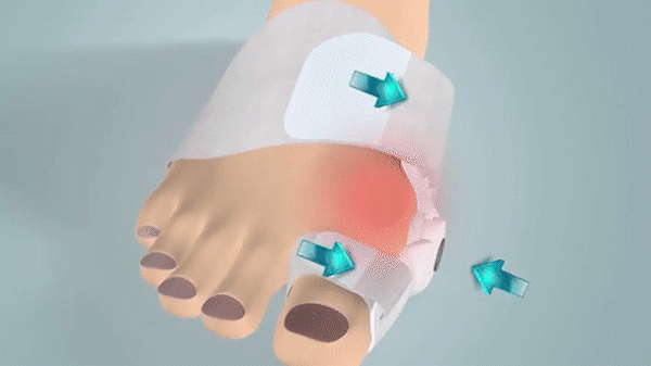 Innovative Technologie zur Knieschmerzbehandlung