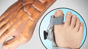 Innovative Technologie zur Knieschmerzbehandlung