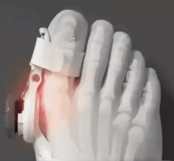 Innovative Technologie zur Knieschmerzbehandlung