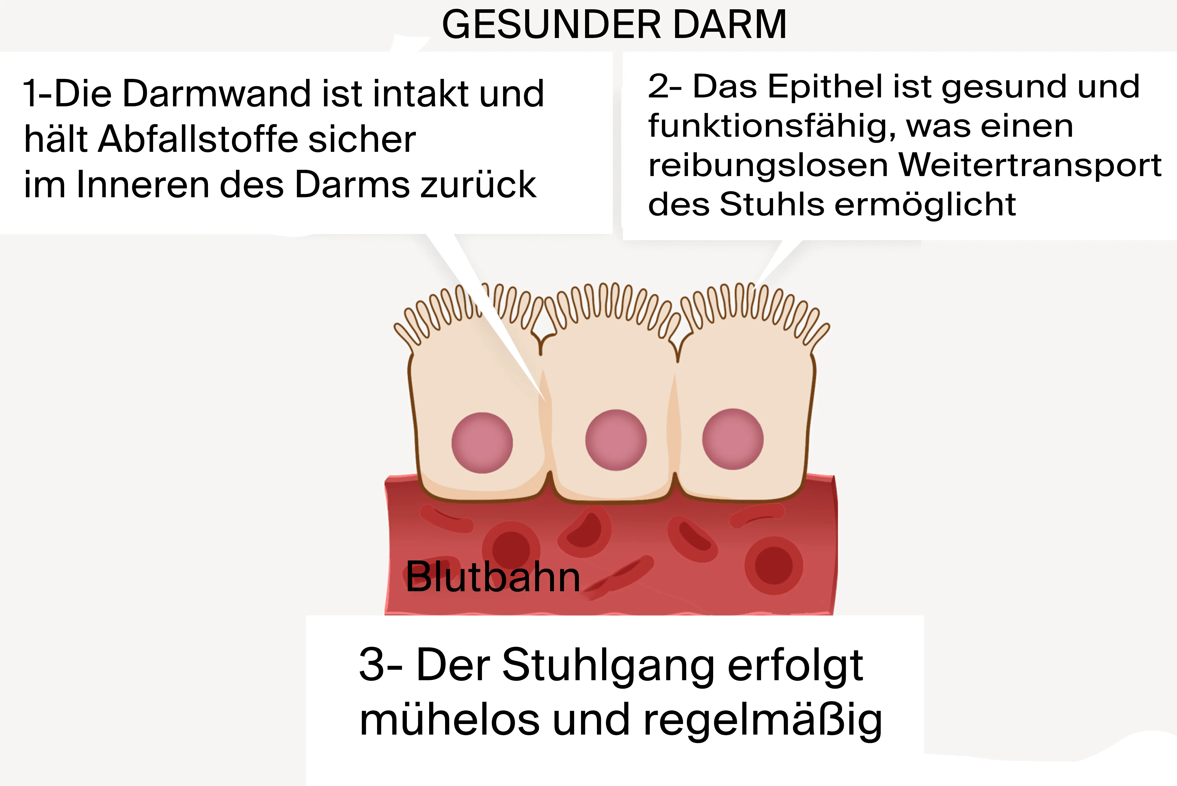Healthy vs Leaky Gut Diagram