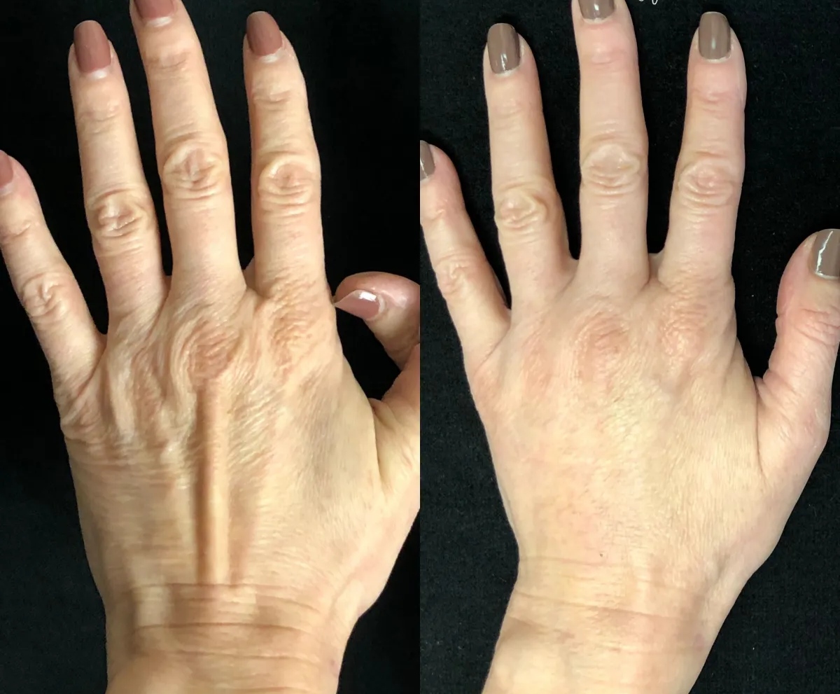 Woman with hair loss