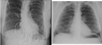 Woman with hair loss