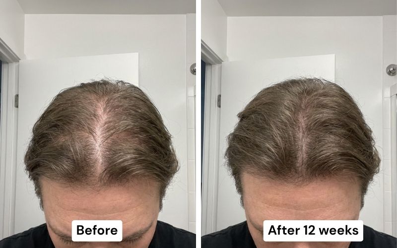 Before and after: diffuse thinning to thick volume