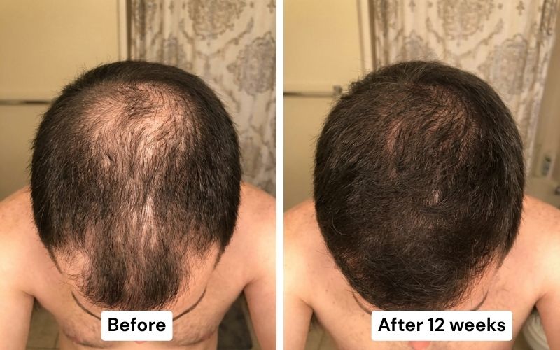 Before and after: crown thinning to full coverage