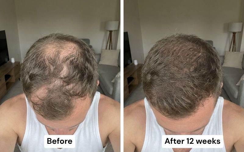 Before and after: bald patch to dense regrowth
