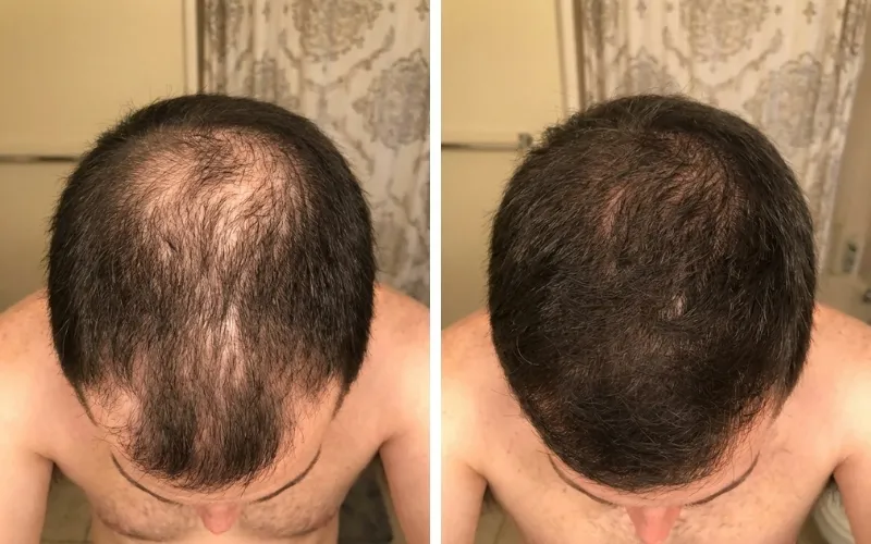 Kevin P. — before and after 16 weeks
