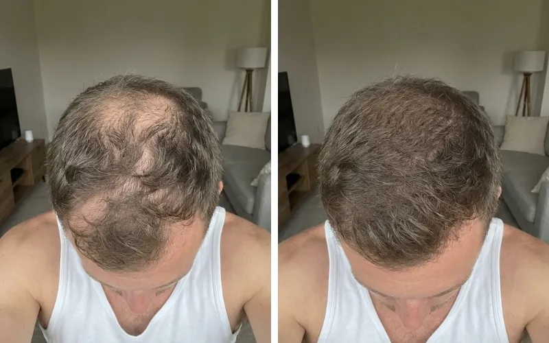 Jason M. — before and after 24 weeks