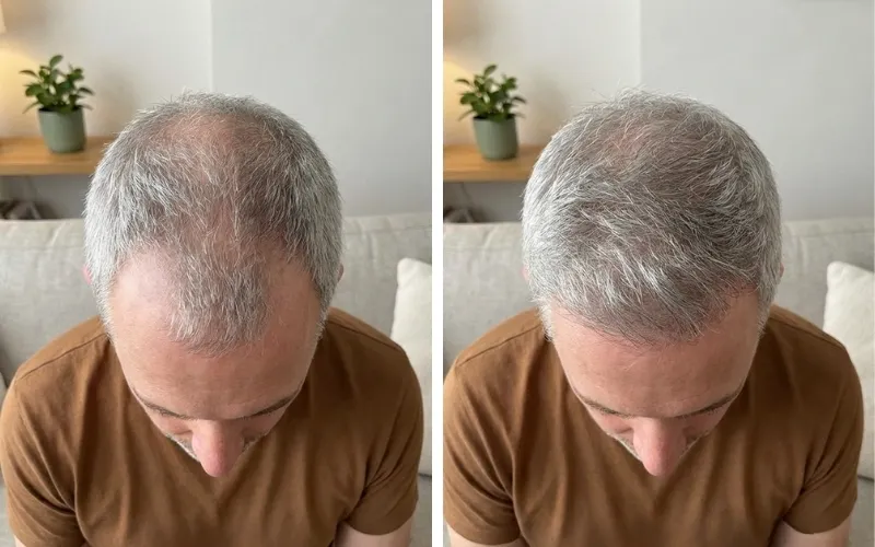 Brian H. — before and after 12 weeks