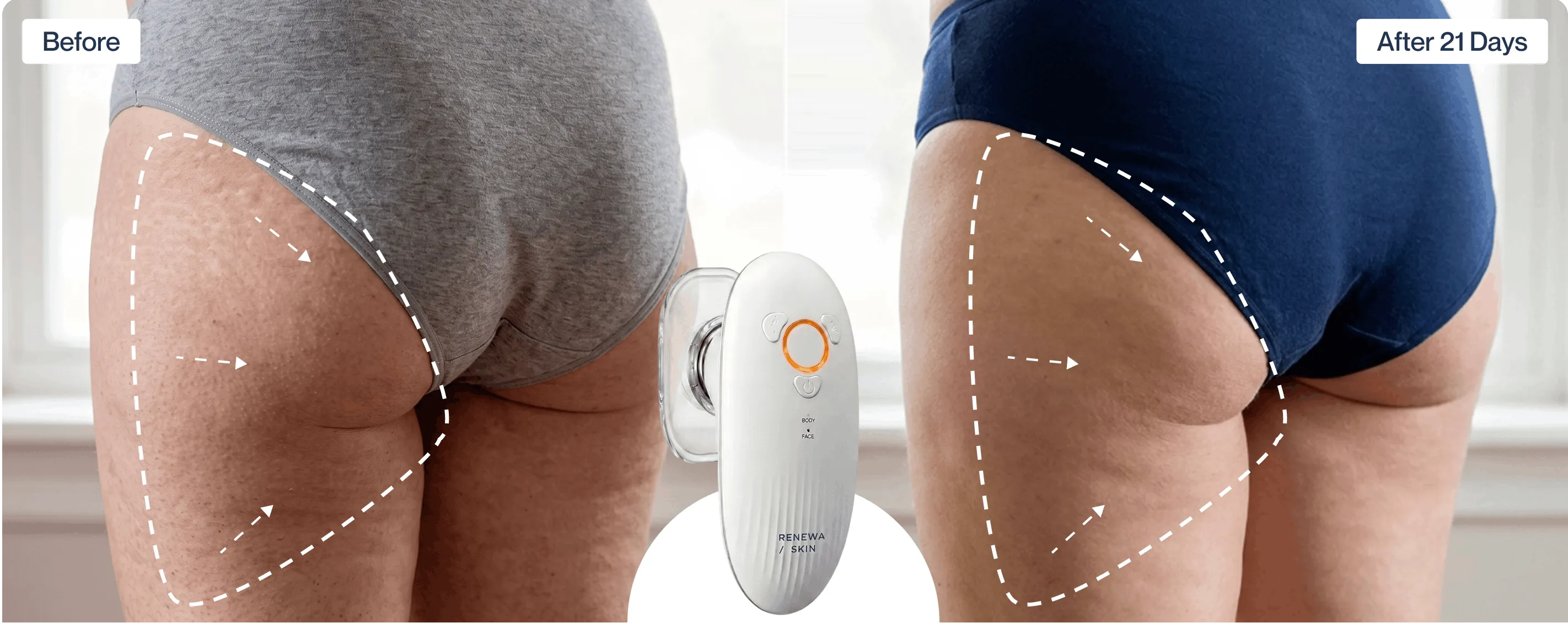Before and after results – mobile