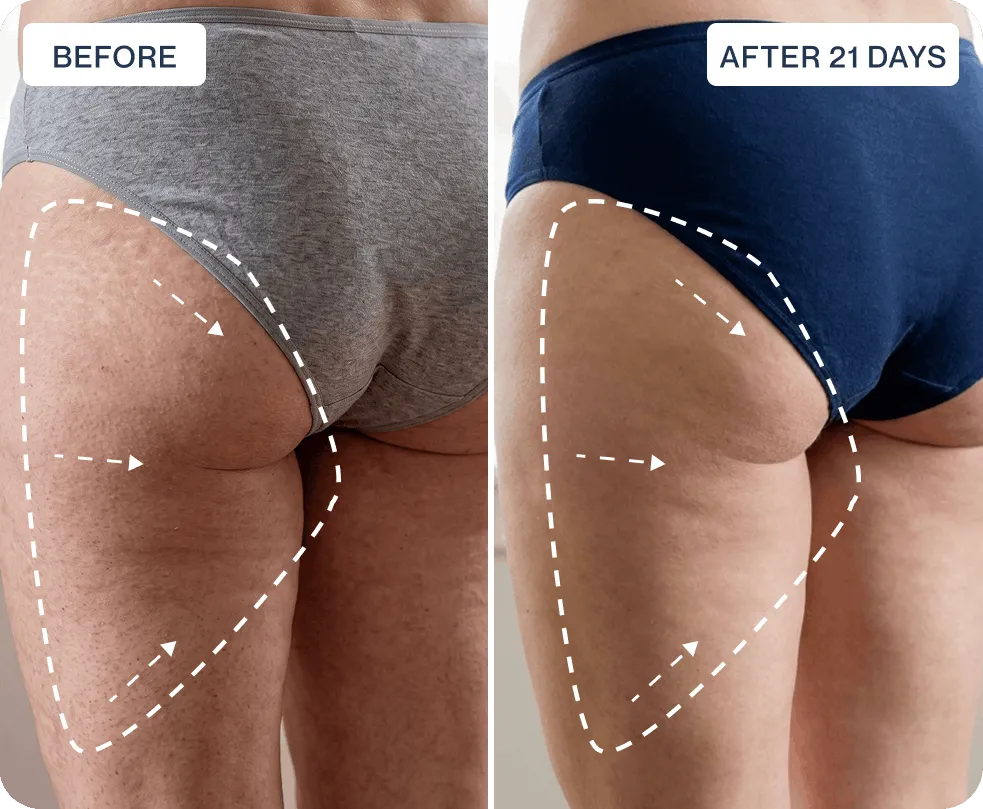 Before and after results – mobile