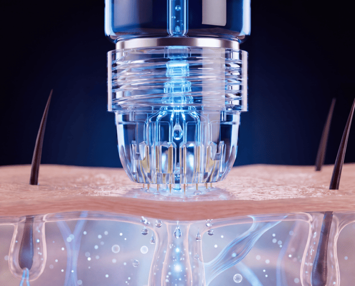 Microneedling activation