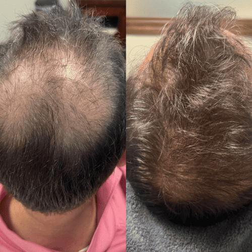 Daniel before and after