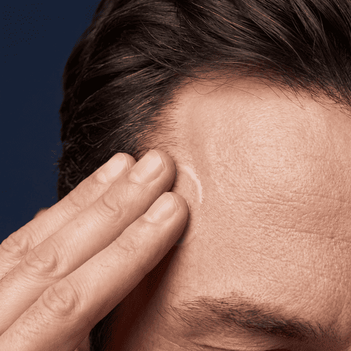 Step 3 pat serum into scalp