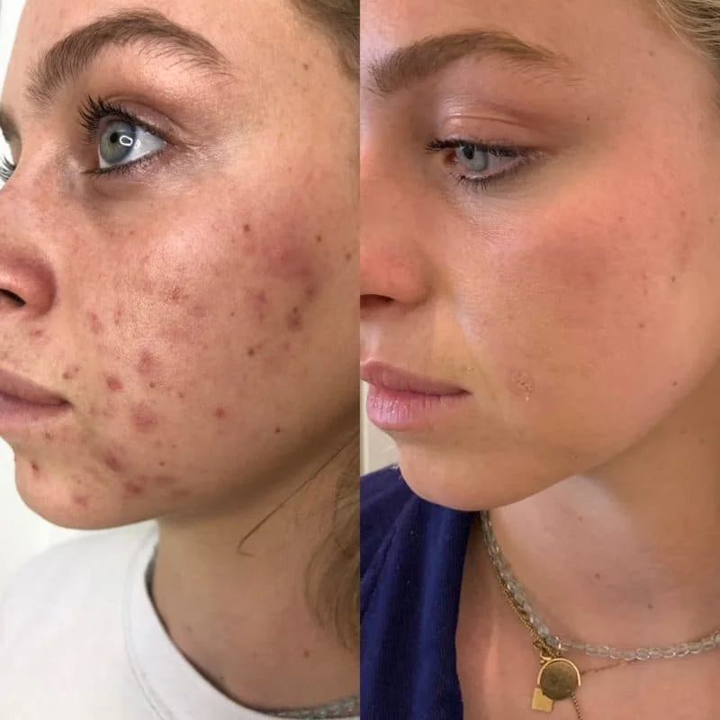 SHOWERENVY BLISSY OFFER