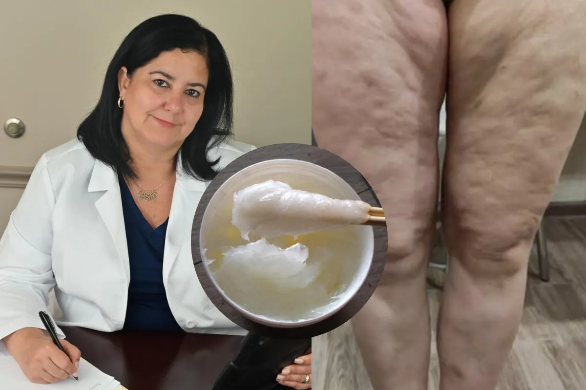 Dermatologist clinical discovery for crepey skin