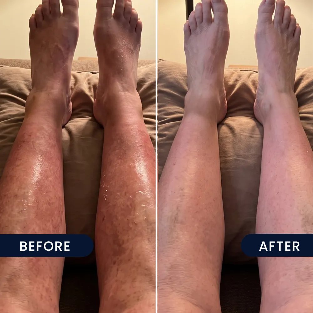 Red, shiny legs, before and after